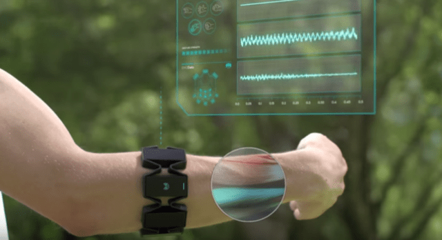 2026超声仪器产业：技术革新驱动市场扩容(图1)